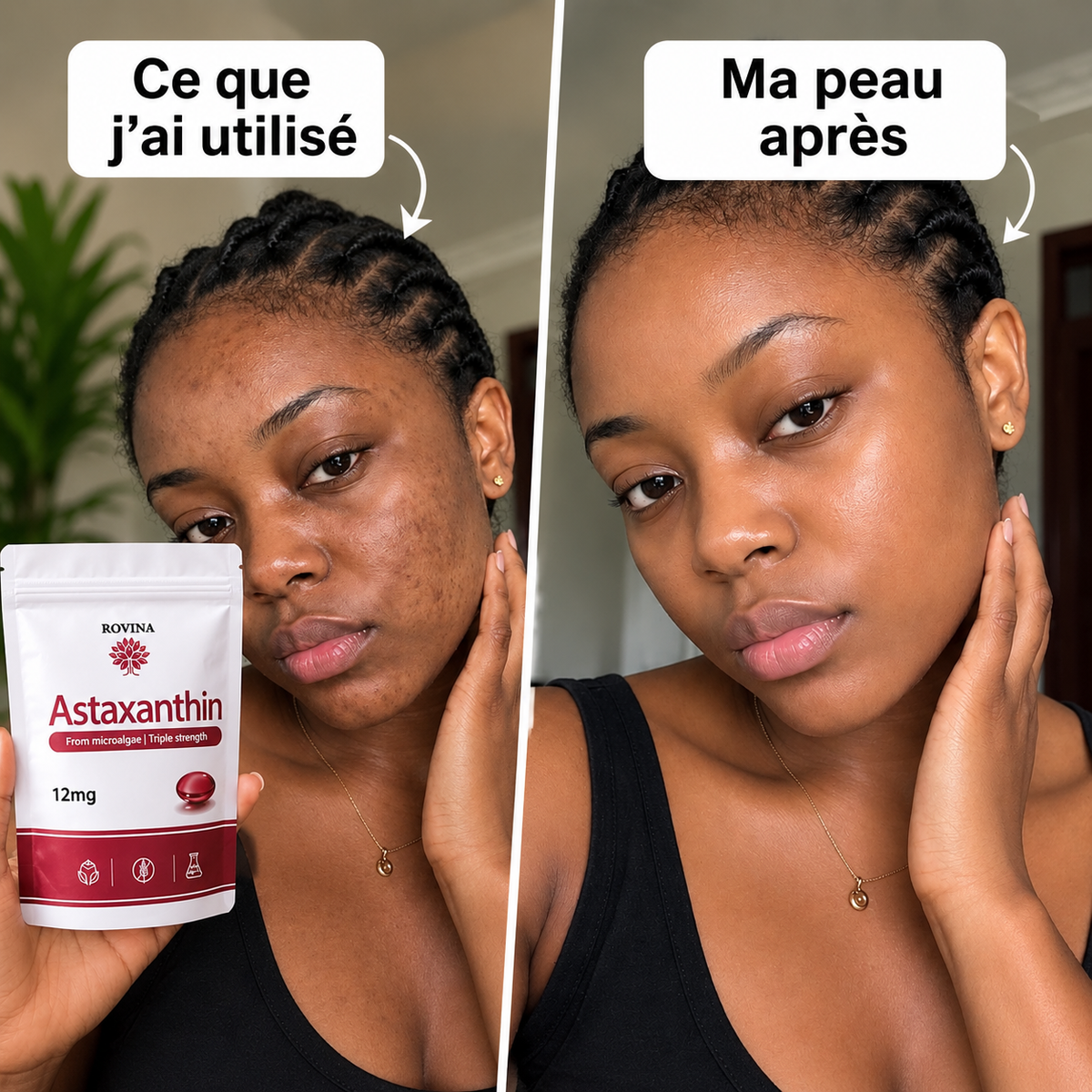𝐀𝐒𝐓𝐀𝐗𝐀𝐍𝐓𝐇𝐈𝐍𝐄 : 𝐋𝐄 𝐒𝐄𝐂𝐑𝐄𝐓 𝐃’𝐔𝐍𝐄 𝐁𝐄𝐋𝐋𝐄 𝐏𝐄𝐀𝐔 𝐀𝐔 𝐍𝐀𝐓𝐔𝐑𝐄𝐋